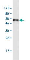 Anti-SULT1A3 Mouse Monoclonal Antibody [clone: 1F3]