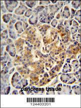 Anti-PRSS3 Rabbit Polyclonal Antibody (PE (Phycoerythrin))