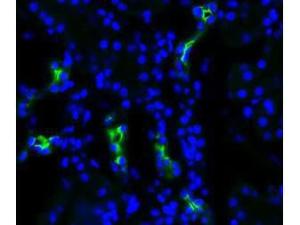 Aquaporin 2 antibody 100 µl