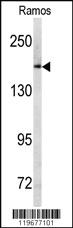 Anti-ABCC1 Rabbit Polyclonal Antibody