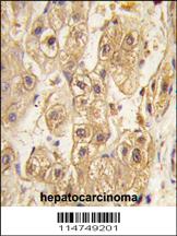 Anti-PDGFRB Rabbit Polyclonal Antibody