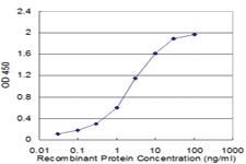 Anti-CRYGD Mouse Monoclonal Antibody [clone: 2H3]