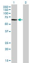 Anti-CHDH Rabbit Polyclonal Antibody