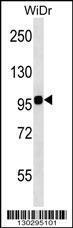 Anti-ITGB7 Rabbit Polyclonal Antibody (AP (Alkaline Phosphatase))