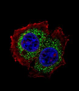 Anti-ESR1 isoform4 Rabbit Polyclonal Antibody (Biotin)