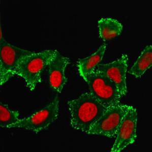 Anti-CD44 antibody