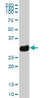 Anti-HLA-DQB1 Mouse Polyclonal Antibody