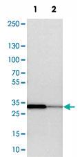 Anti-SLC25A22 Rabbit Polyclonal Antibody