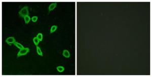 Immunofluorescence analysis of LOVO cells using Anti-LGR6 Antibody. The right hand panel represents a negative control, where the Antibody was pre-incubated with the immunising peptide