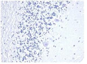 Anti-CD3 epsilon Rabbit Recombinant Antibody [clone: C3e/4652R]