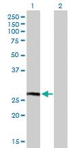 Anti-HLA-DQB1 Mouse Polyclonal Antibody