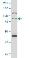 Anti-RPS6KA2 Mouse Monoclonal Antibody [clone: 1F6]