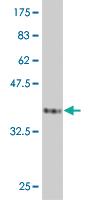 Anti-PPP1R2 Mouse Monoclonal Antibody [clone: 2E9]