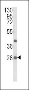 Anti-EIF4E2 Rabbit Polyclonal Antibody (Biotin)