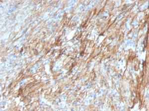 Immunohistochemical analysis of formalin-fixed, paraffin-embedded human lung using Anti-Fibronectin Antibody [FN1/3029]