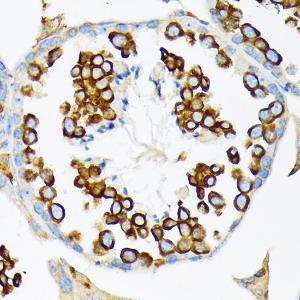 Immunohistochemistry analysis of paraffin-embedded mouse testis using Anti-Calmegin Antibody [ARC2214] (A305871) at a dilution of 1:100 (40X lens). Perform microwave antigen retrieval with 10 mM Tris/EDTA buffer pH 9.0 before commencing with IHC staining protocol