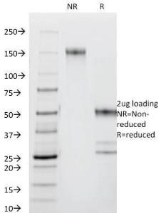 Anti-CD44 antibody