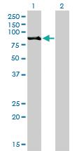 Anti-RPS6KA2 Mouse Monoclonal Antibody [clone: 1F6]