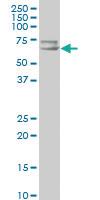 Anti-SLC22A4 Mouse Polyclonal Antibody