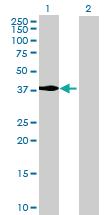 Anti-MECR Mouse Polyclonal Antibody