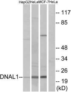 Western blot analysis of lysates from HeLa, HepG and MCF-7 cells using Anti-DNAL1 Antibody. The right hand lane represents a negative control, where the antibody is blocked by the immunising peptide