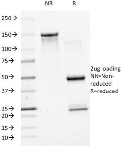 SDS-PAGE analysis of Anti-SUMO-1 Antibody [SM1/495] under non-reduced and reduced conditions; showing intact IgG and intact heavy and light chains, respectively. SDS-PAGE analysis confirms the integrity and purity of the antibody