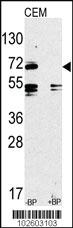 Anti-TLR2 Rabbit Polyclonal Antibody