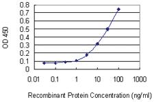 Anti-DEAF1 Mouse Monoclonal Antibody [clone: 1H8]