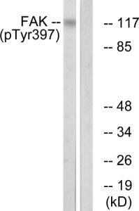 Western blot analysis of lysates from Jurkat cells treated with Ca2+ 40nM 30' using Anti-FAK (phospho Tyr397) Antibody. The right hand lane represents a negative control, where the antibody is blocked by the immunising peptide