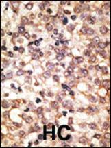 Anti-TLR2 Rabbit Polyclonal Antibody