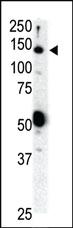 Anti-RET Rabbit Polyclonal Antibody