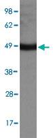 Anti-PDK4 Rabbit Polyclonal Antibody