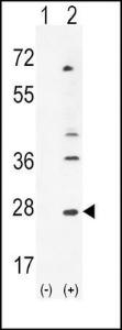 Anti-LIF Rabbit Polyclonal Antibody (Biotin)