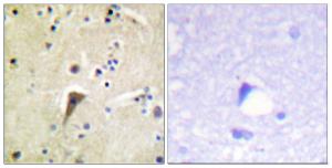 Immunohistochemical analysis of paraffin-embedded human brain using Anti-FAK (phospho Tyr397) Antibody. The right hand panel represents a negative control, where the antibody was pre-incubated with the immunising peptide