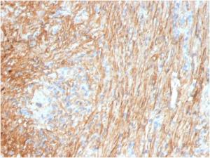 Immunohistochemical analysis of formalin-fixed, paraffin-embedded human lung using Anti-Fibronectin Antibody [FN1/3036]