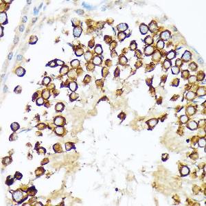 Immunohistochemistry analysis of paraffin-embedded rat testis using Anti-Calmegin Antibody [ARC2214] (A305871) at a dilution of 1:100 (40X lens). Perform microwave antigen retrieval with 10 mM Tris/EDTA buffer pH 9.0 before commencing with IHC staining protocol