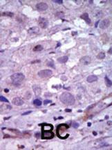 Anti-RET Rabbit Polyclonal Antibody