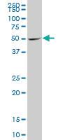 Anti-DEAF1 Mouse Monoclonal Antibody [clone: 3F11]