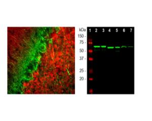 Left: Analysis of alpha-internexin expression (green) by IHC. Co-staining was performed with chicken antibody to calretinin (red). Right: Western blot analysis of alpha-internexin expression in tissue lysates.