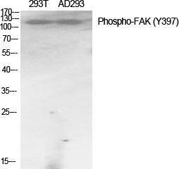 Western blot analysis of various cells using Anti-FAK (phospho Tyr397) Antibody