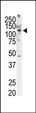 Anti-RET Rabbit Polyclonal Antibody