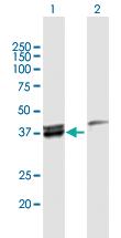 Anti-MECR Rabbit Polyclonal Antibody