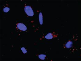 Anti-PTK2 + PLCG1 Antibody Pair