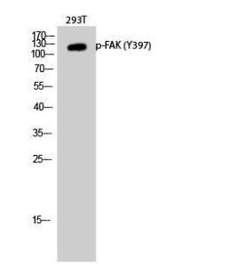 Western blot analysis of 293T cells using Anti-FAK (phospho Tyr397) Antibody