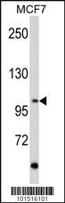 Anti-RET Rabbit Polyclonal Antibody