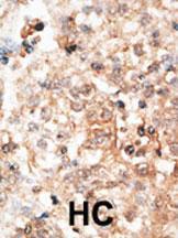 Anti-Osteocalcin Rabbit Polyclonal Antibody (AP (Alkaline Phosphatase))