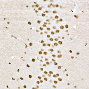 Immunohistochemistry analysis of paraffin-embedded mouse brain using Anti-CREB (phospho Ser133) Antibody (A10868) at a dilution of 1:100 (40x lens). Perform high pressure antigen retrieval with 10 mM citrate buffer pH 6.0 before commencing with IHC staining protocol.