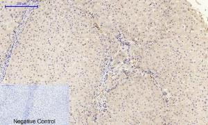 Immunohistochemical analysis of paraffin-embedded human liver tissue using Anti-FAK (phospho Tyr397) Antibody at 1:200 (4°C overnight). Negative control was secondary antibody only