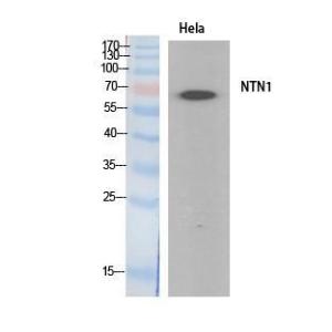 Western blot analysis of extracts from HeLa cells using Anti-NTN1 Antibody