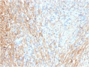 Immunohistochemical analysis of formalin-fixed, paraffin-embedded human lung using Anti-Fibronectin Antibody [FN1/3036]